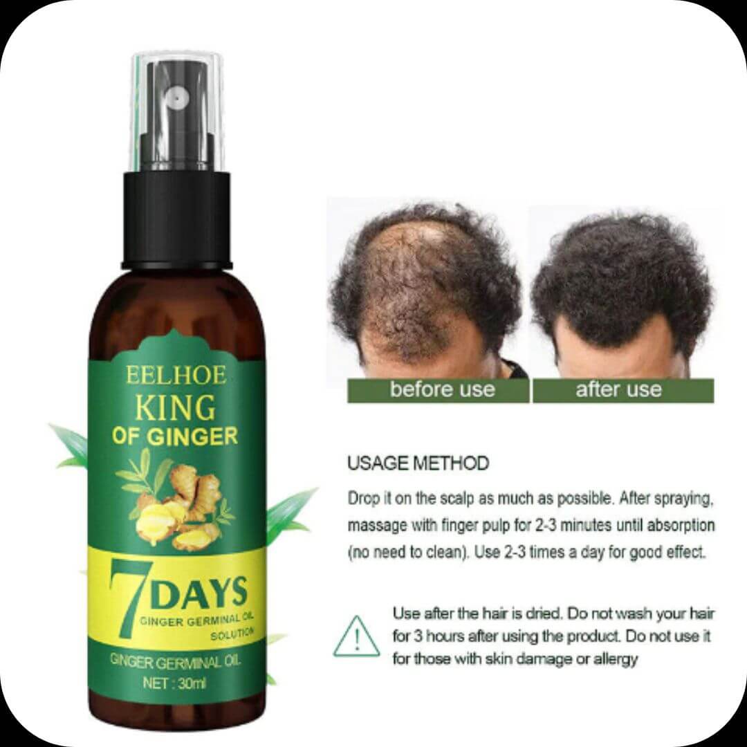 EELHOE King Of Ginger® Milagroso Elixir para el Cabello