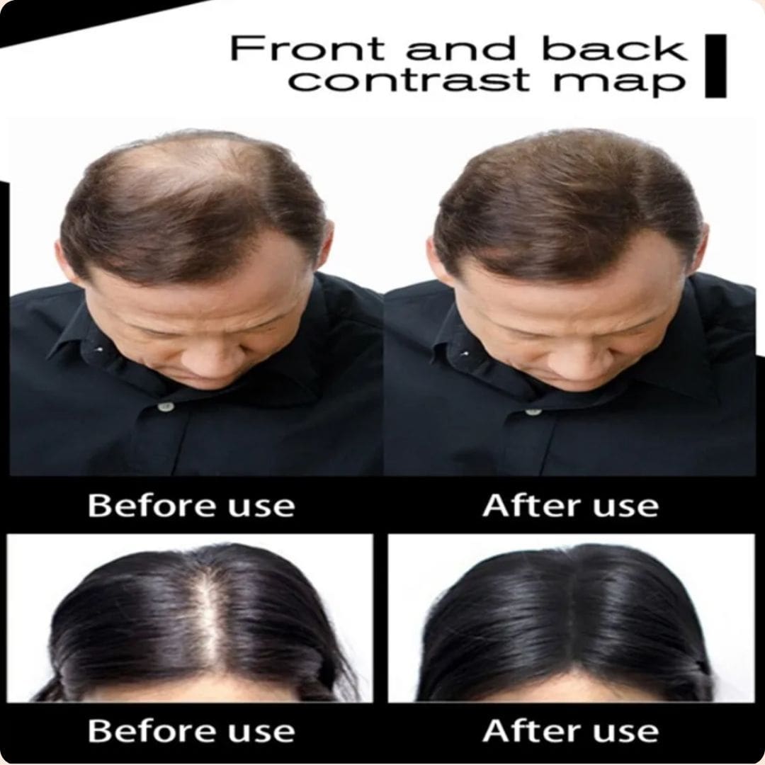 🤩 TOPPIK 🤩 Fibras Capilares con Keratina