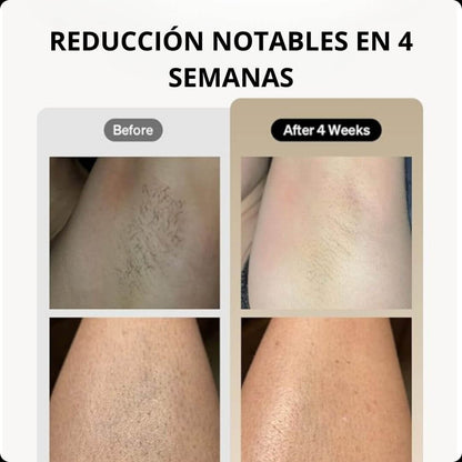 ClearTouch™ - Suavidad Instantanea