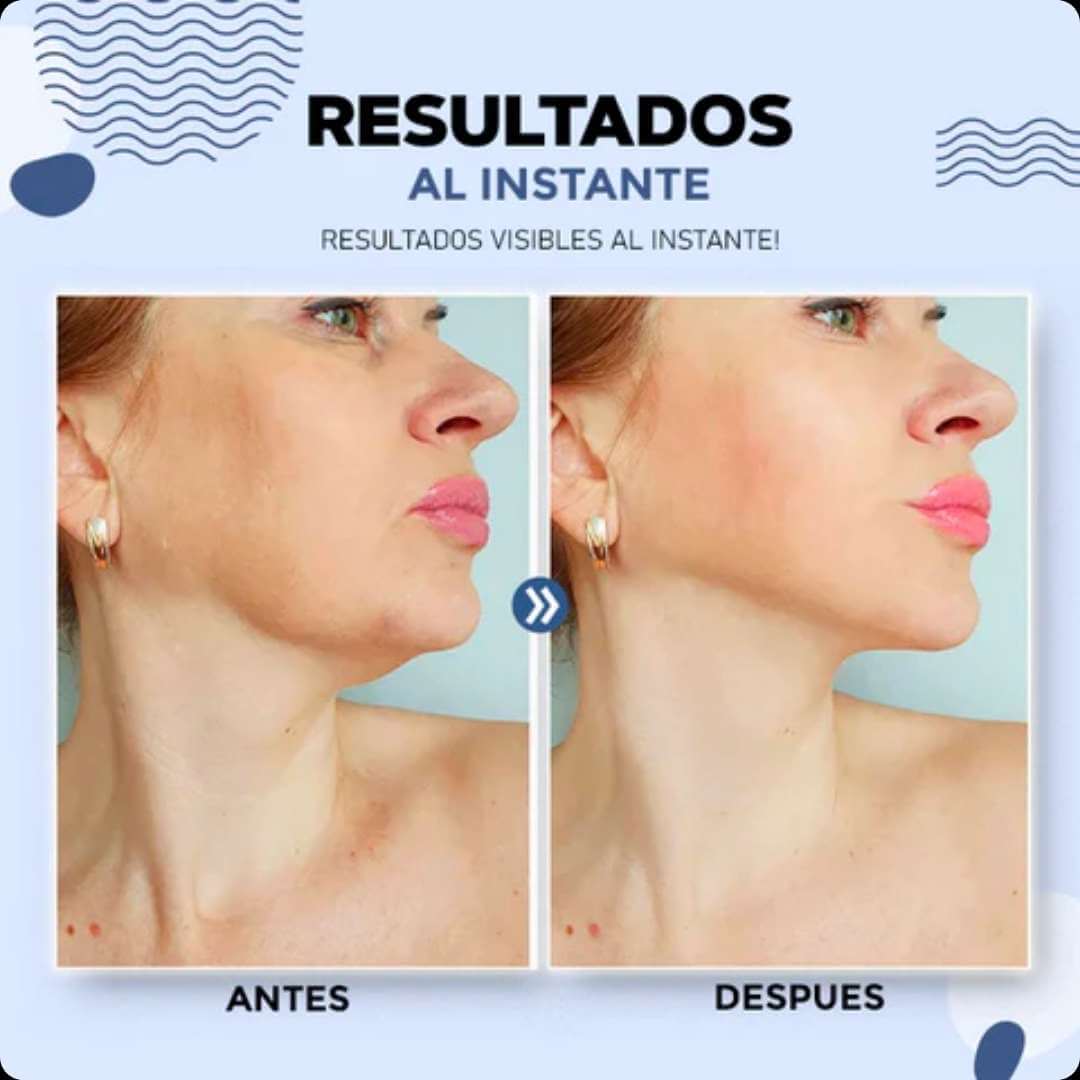 CINTA LEVANTADORA DE ROSTRO - COUNTOURLIFT™ (Pack 40 unidades)