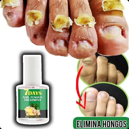 NailRevita Pro™ -Fortaleza y Crecimiento Superior para Tus Uñas