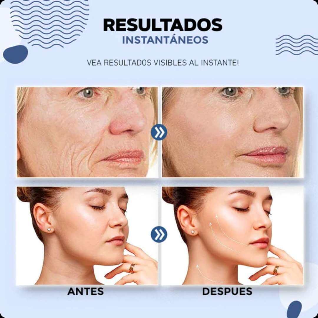 CINTA LEVANTADORA DE ROSTRO - COUNTOURLIFT™ (Pack 40 unidades)