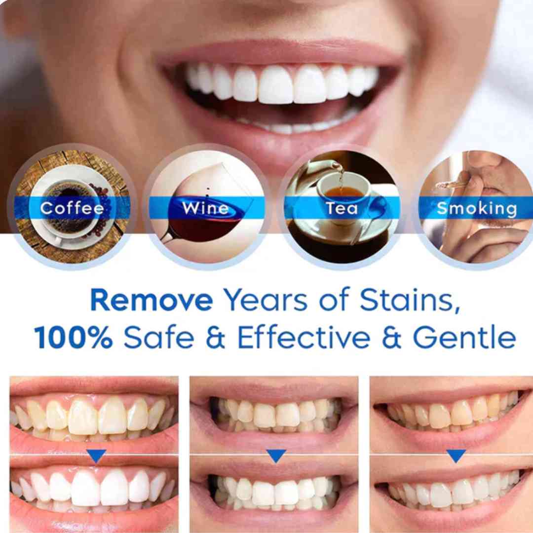 🎁 Paga 1 lleva 3 - LANTHOME™ Esencia Blanqueadora de Dientes