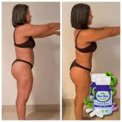 Bye Bye Celulitis Secret